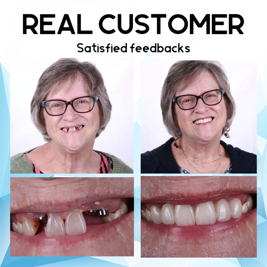 DentaFlex™ - Silicone-Reline Denture Set