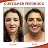 SecureSmile™ — Soft Silicone Support for Perfect Denture Fit