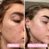 2+2 FREE | BrightEase™ – Unveil radiant, even skin that turns heads