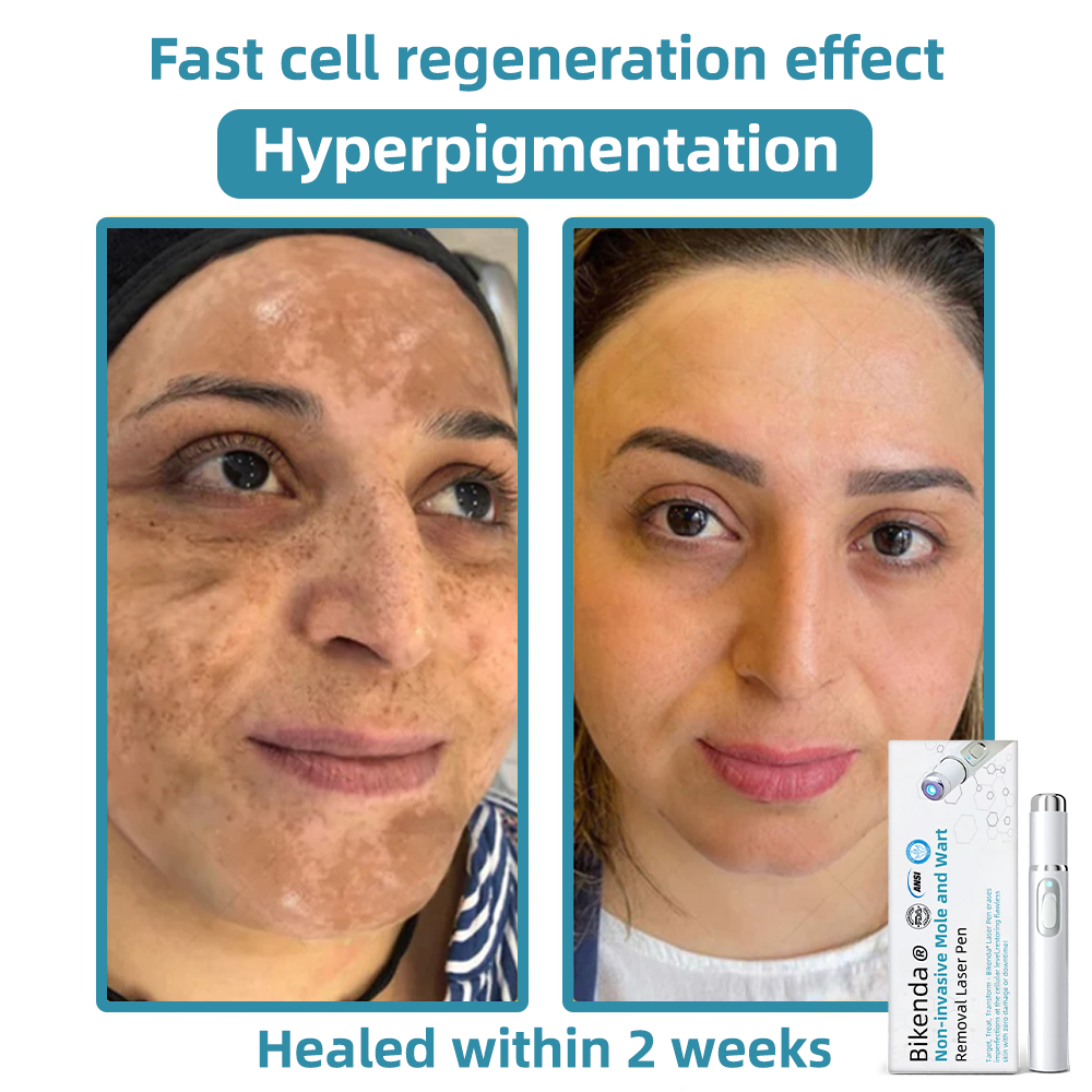 LumiDerm™ – Reveal Radiant, Flawless Skin and Achieve Quick Confidence