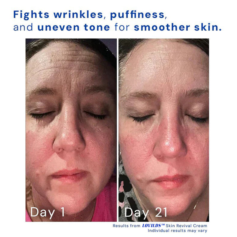 1+1 Free | Skin Revival Cream™ Smooths Imperfections