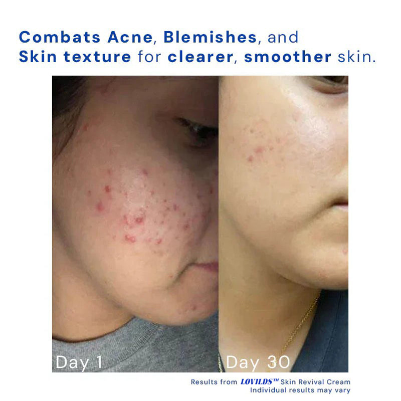 1+1 Free | Skin Revival Cream™ Smooths Imperfections