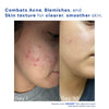 1+1 Free | Skin Revival Cream™ Smooths Imperfections