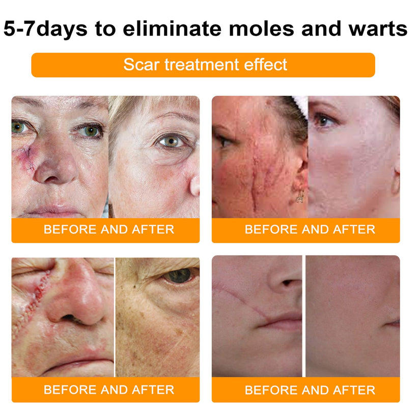 1+1 Free | NEWYOU™ TagLift Neck Gift Treatment — Painless Skin Renewal for Clear, Confident Skin