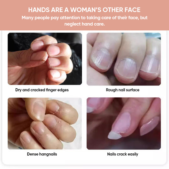 1+1 FREE | Nails Pro™ Nourishing Nail Growth Oil