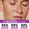 1+1 Free | Ceoerty™ MelantraX Advanced Anti-Hyperpigmentation Essence — Reveal radiant, flawless skin you'll love
