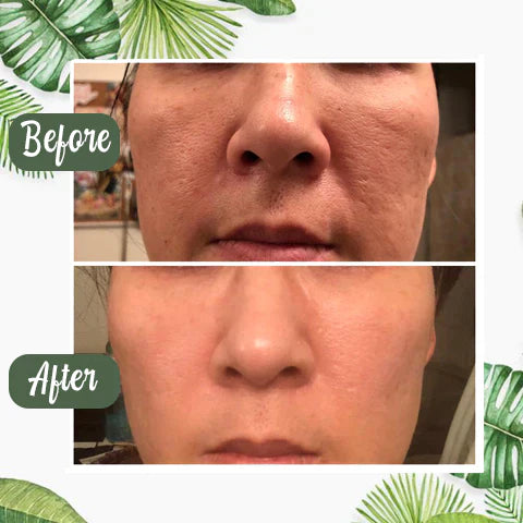 1+1 FREE | Poreless Deep Cleanse Mask Stick™ — Reveals fresh, radiant skin without blackheads and shine