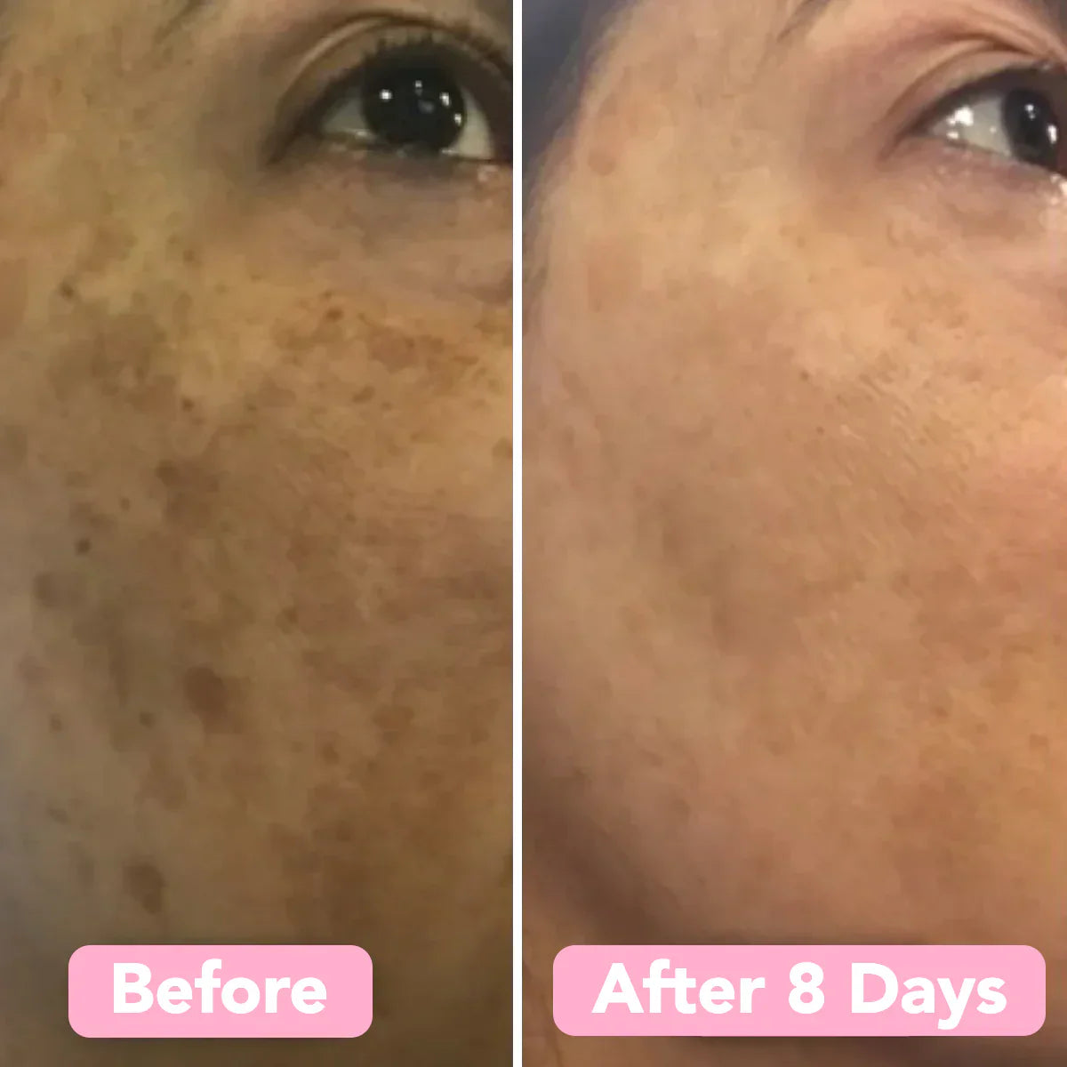 2+2 FREE | BrightEase™ – Unveil radiant, even skin that turns heads