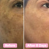 2+2 FREE | BrightEase™ – Unveil radiant, even skin that turns heads