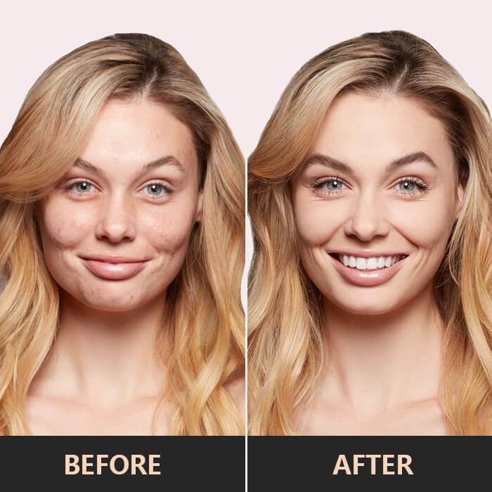 1+1 Free | Concealer™ Contouring and Brightening Makeup