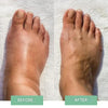 InstantRelief™ — Say Goodbye to Foot Pain and Welcome Every Step with Comfort