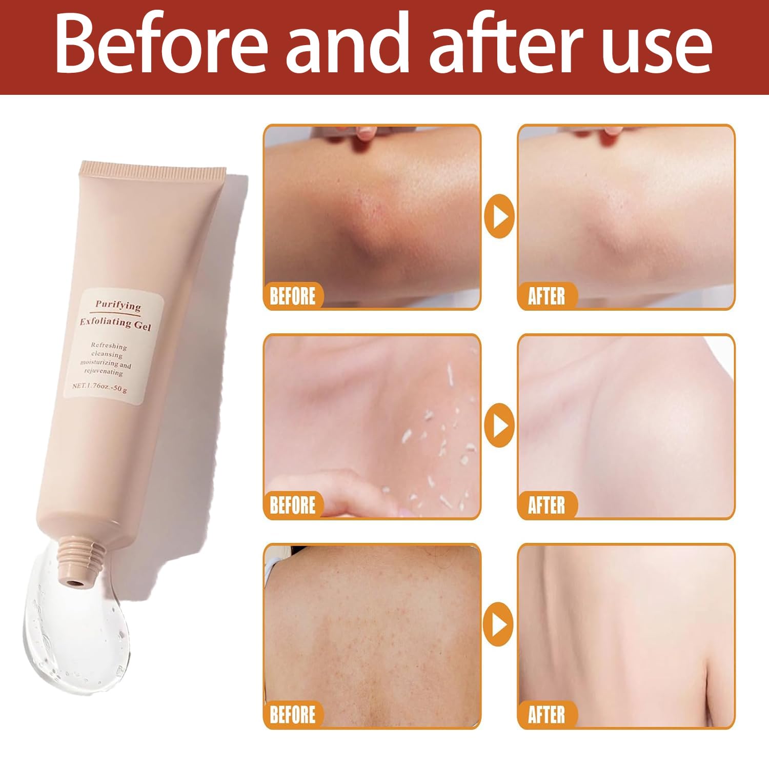 1+1 FREE | FreshSkin™ Removes dull skin without harsh scrubbing