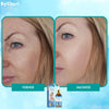 1+1 FREE | YouthGlow™  Botox Anti-Aging Serum