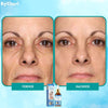 1+1 FREE | YouthGlow™  Botox Anti-Aging Serum