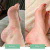 InstantRelief™ — Say Goodbye to Foot Pain and Welcome Every Step with Comfort