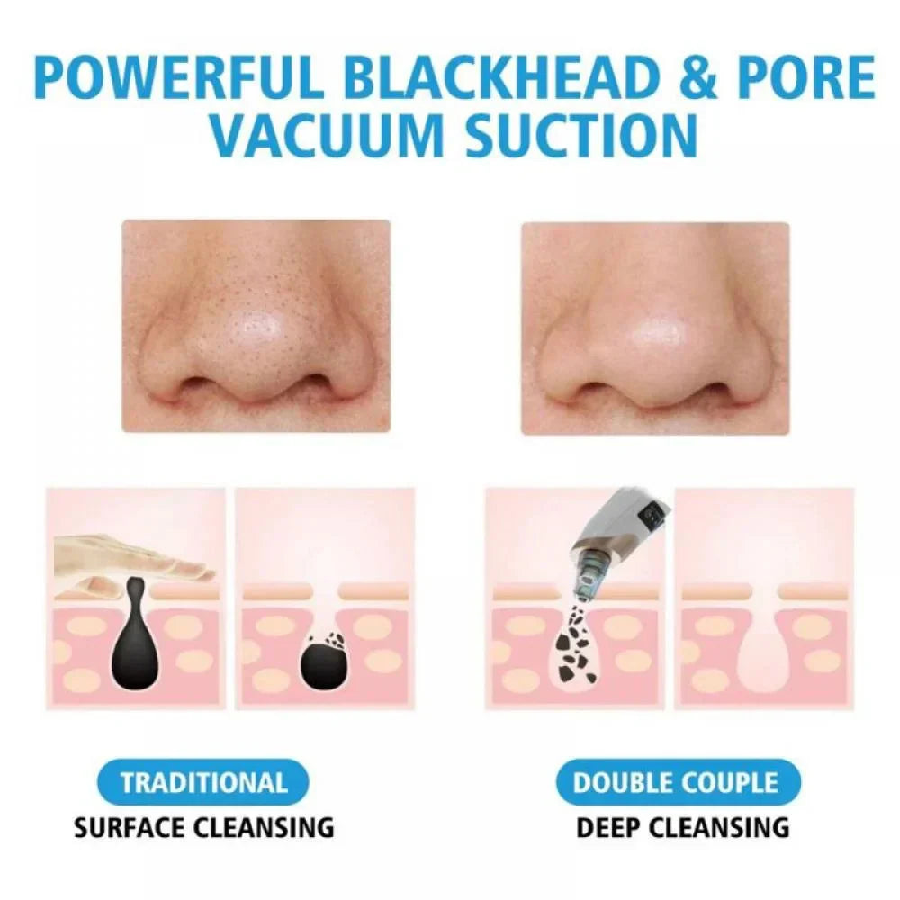 Porex™ - Reduce Oil and Unclog Pores with Ease