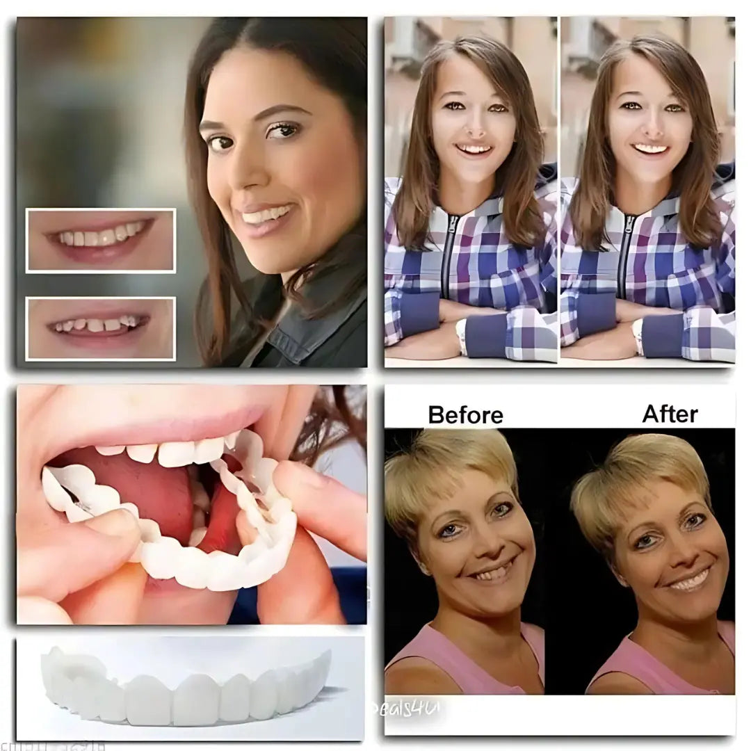 1+1 Free | SnapSmiles™ Snap-on Dentures