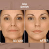 LiftEase™ - Invisible, Firming Treatment!