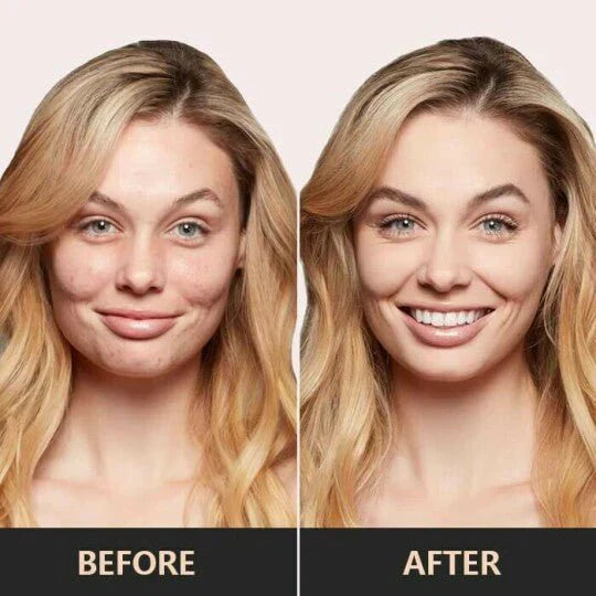 1+1 Free | Glowshroom™ - Achieve a Radiant Complexion