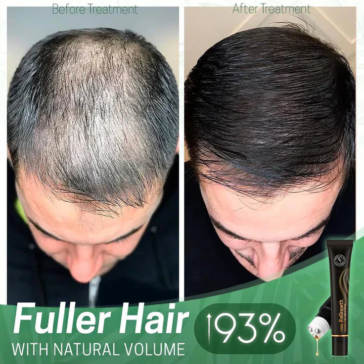 1+1 FREE | StrandSavior™ Prevents Bald Spots