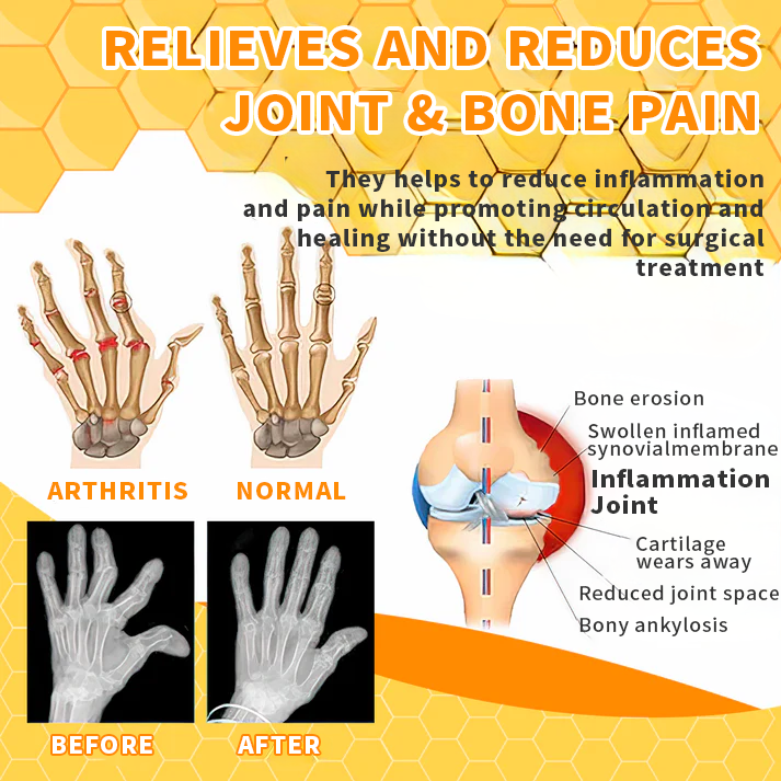 1+1 Free | TAILEDEN™ Bee Venom Joint Therapy Pain Gel – Relieve Pain and Regain Active Joy