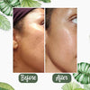 1+1 FREE | Poreless Deep Cleanse Mask Stick™ — Reveals fresh, radiant skin without blackheads and shine
