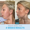ContourVive™ – Tighten and Define Your Jawline for Timeless Confidence