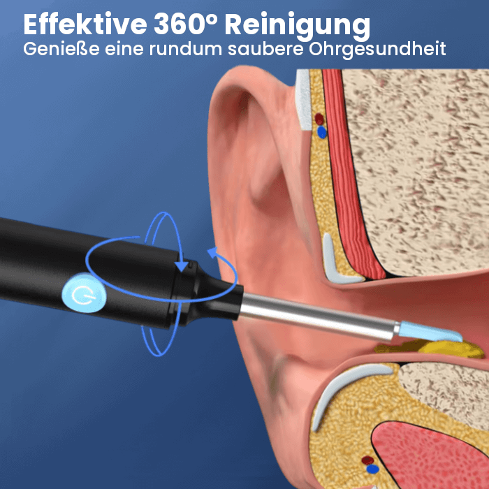 CleanEars™ - Intelligent Ear Cleaner with HD Camera