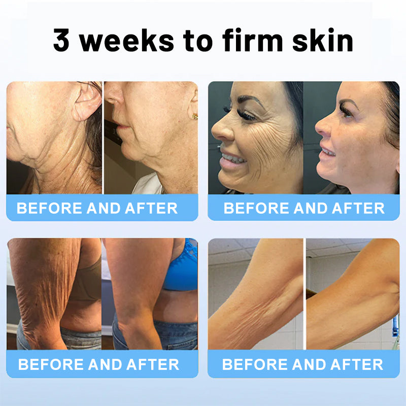 1 + 1 Free | Liftora™ - Luxurious Lifting Stick with Bee Venom and Peptides