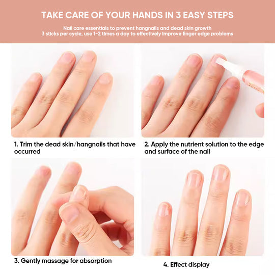 1+1 FREE | Nails Pro™ Nourishing Nail Growth Oil