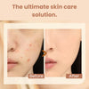 AgelessGlow™ - Say Goodbye to Mismatched Foundation Shades