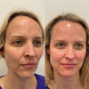 PureLure™ Deep Cleaner — Lets you achieve professional-level skin care from the comfort of your home