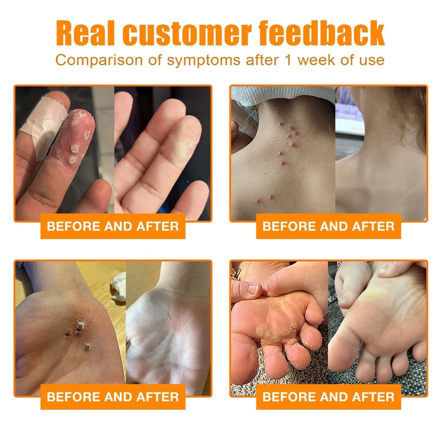 1+1 Free | NEWYOU™ TagLift Neck Gift Treatment — Painless Skin Renewal for Clear, Confident Skin