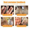 1+1 Free | NEWYOU™ TagLift Neck Gift Treatment — Painless Skin Renewal for Clear, Confident Skin
