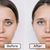 LumiVive™ – Wake up to instantly brighter, younger-looking eyes