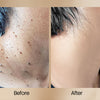 1+1 FREE | BeeClear™ Get Rid Of Skin Problems