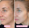 2+2 FREE | BrightEase™ – Unveil radiant, even skin that turns heads