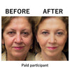 1+1 FREE | Instant Temporary Skin Tightener™  Reveal Smooth, Youthful Skin in Minutes