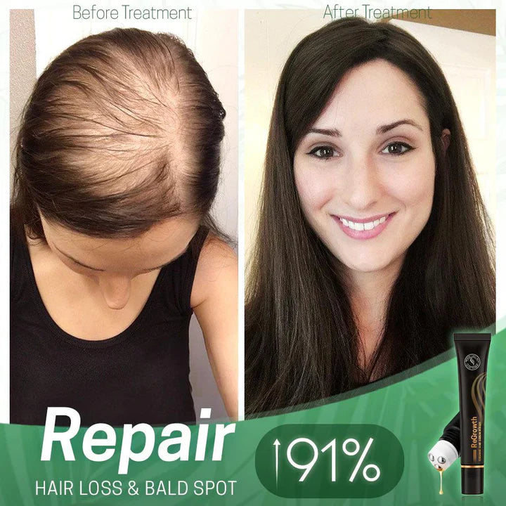 1+1 FREE | NextGrow™ Stop Hair Loss and Stimulate Growth Naturally