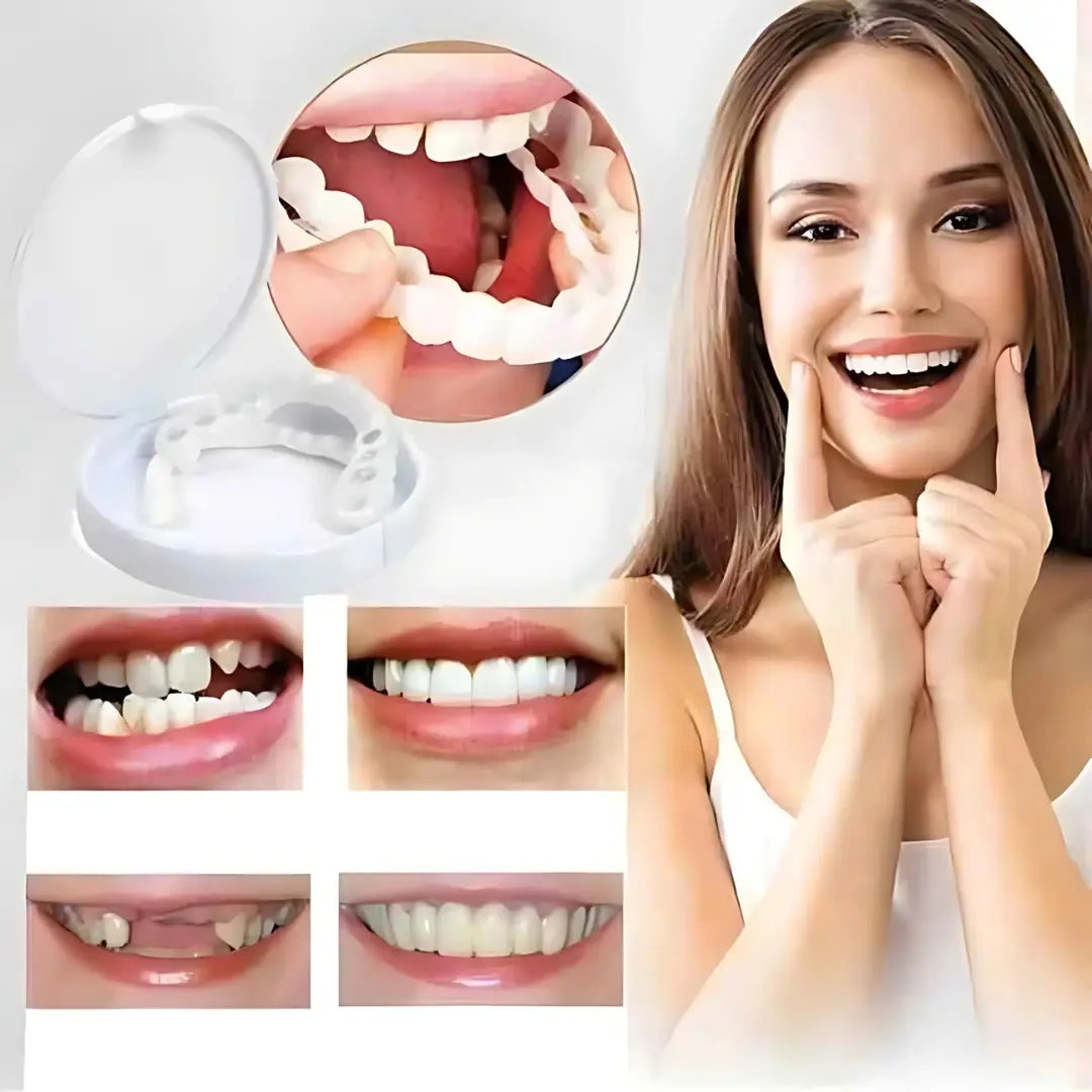 1+1 Free | SnapSmiles™ Snap-on Dentures