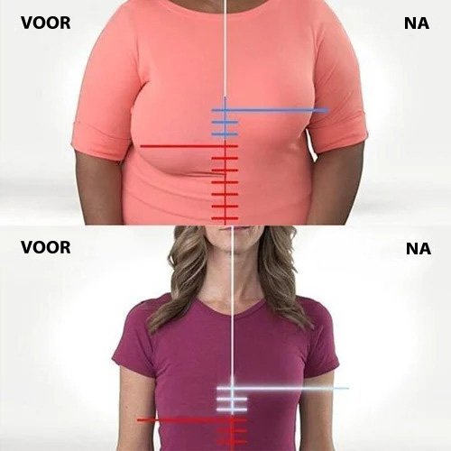 1+1 Free | Sabine™ - Supportive Bra with Pre-closure