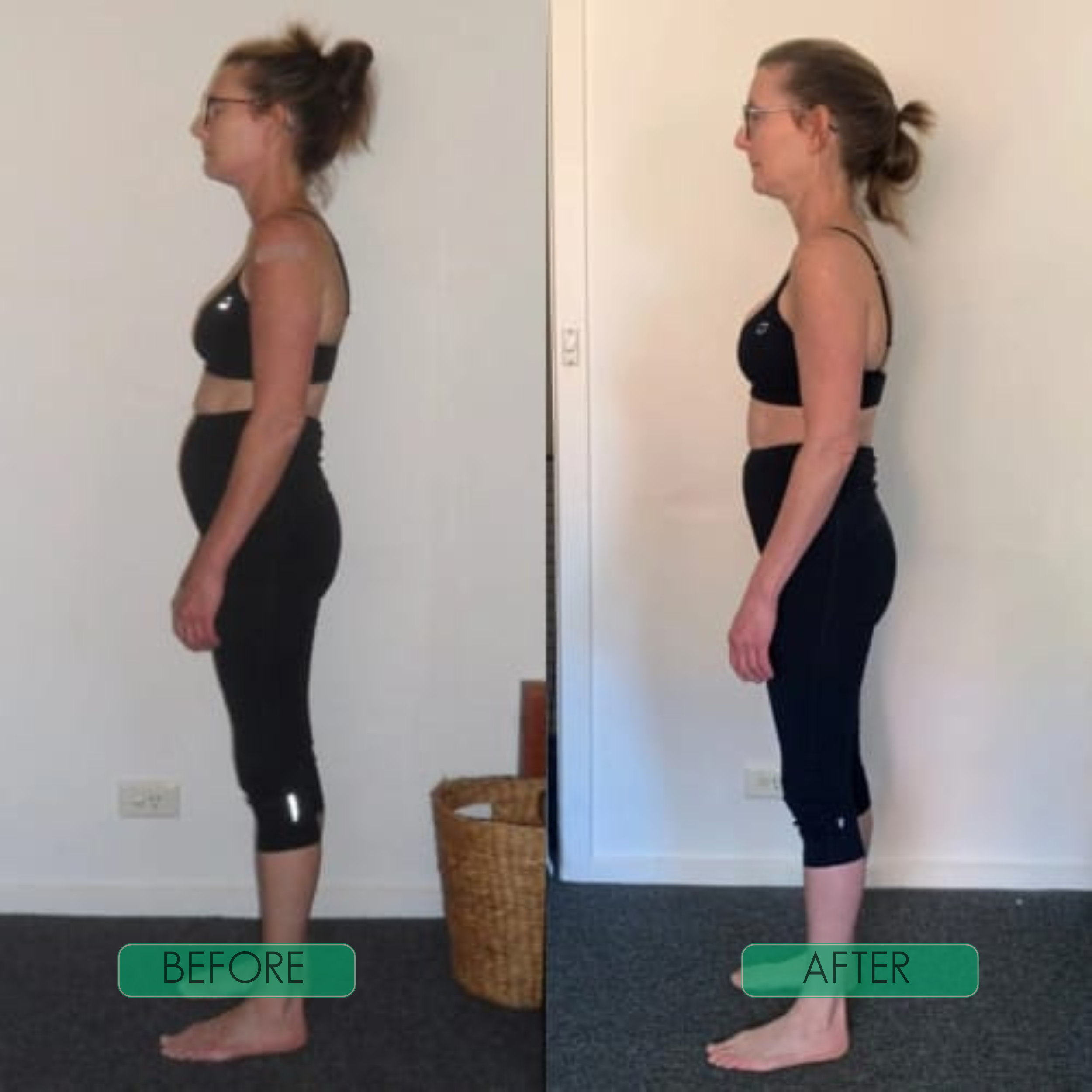AlignPro™ — Feel stronger all day and stand taller