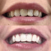 1+1 Free | Diamond Smile™ — Unleash Your Shine and Shine with Confidence