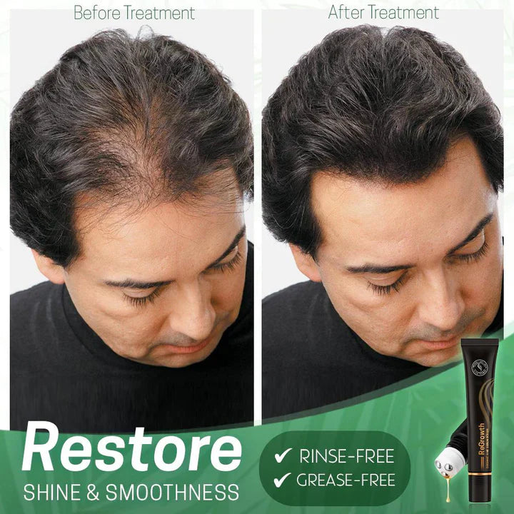 1+1 FREE | NextGrow™ Stop Hair Loss and Stimulate Growth Naturally