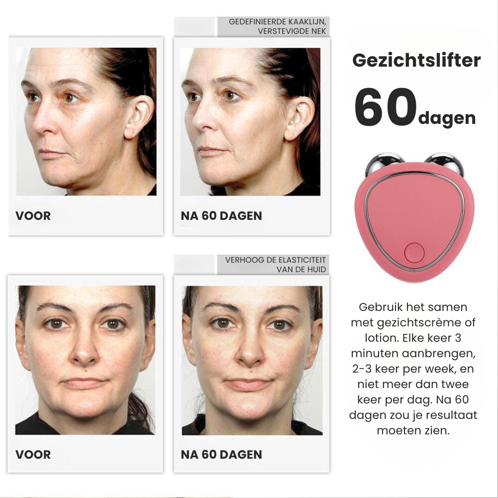 YouthNourish™ - Facial Massage Device