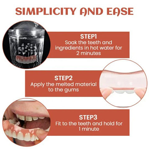 SecureSmile™ — Soft Silicone Support for Perfect Denture Fit