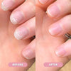 1+1 FREE | Nails Pro™ Nourishing Nail Growth Oil
