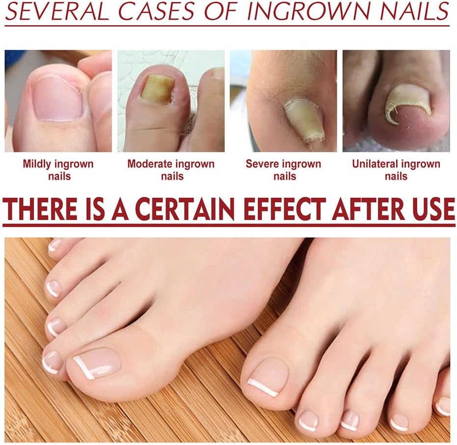 HealDrop™ - Regenerate Damaged Nails in 4 Weeks
