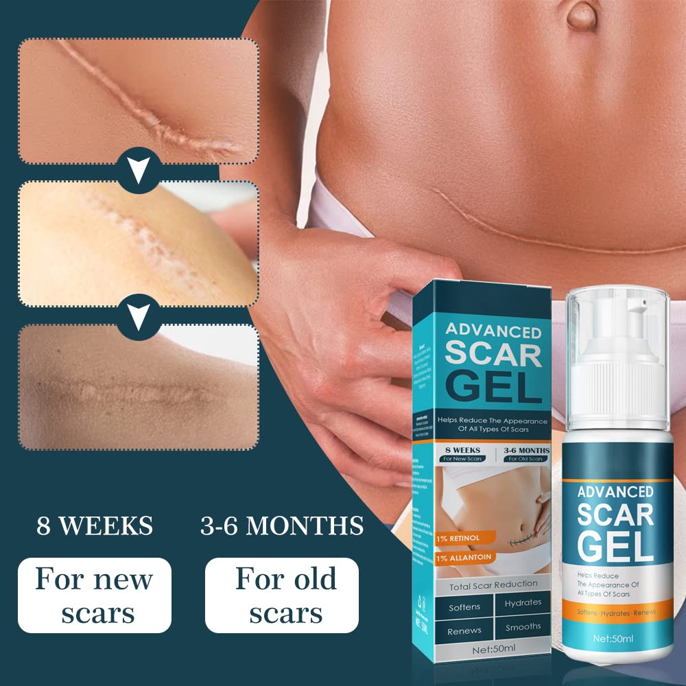 1+1 FREE | ScarEase™ Smooths Skin Texture!