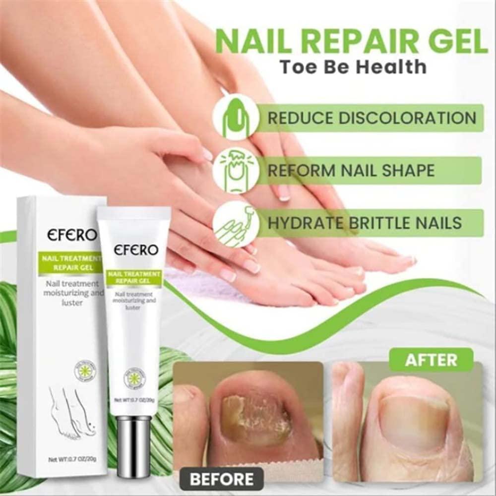 1+1 FREE | RejuveNail™ Powerful Nail Repair: Strong, Healthy Nails!